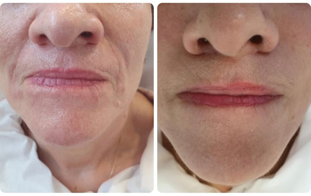 Screenshot_20230525_201829_Facebook