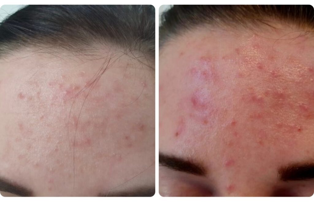 Screenshot_20230819_181426_Facebook