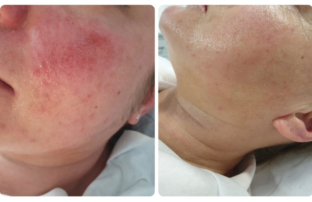 Screenshot_20230819_181948_Facebook