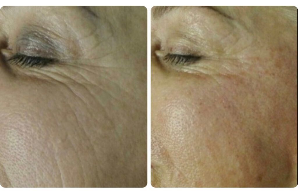 Screenshot_20230819_182113_Facebook