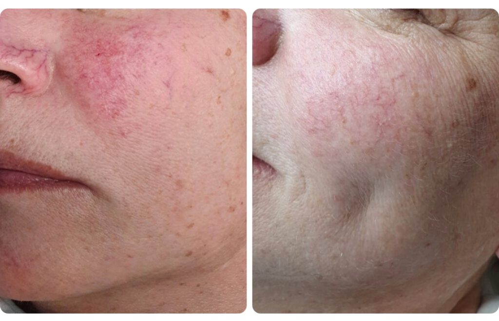 Screenshot_20230819_182345_Facebook