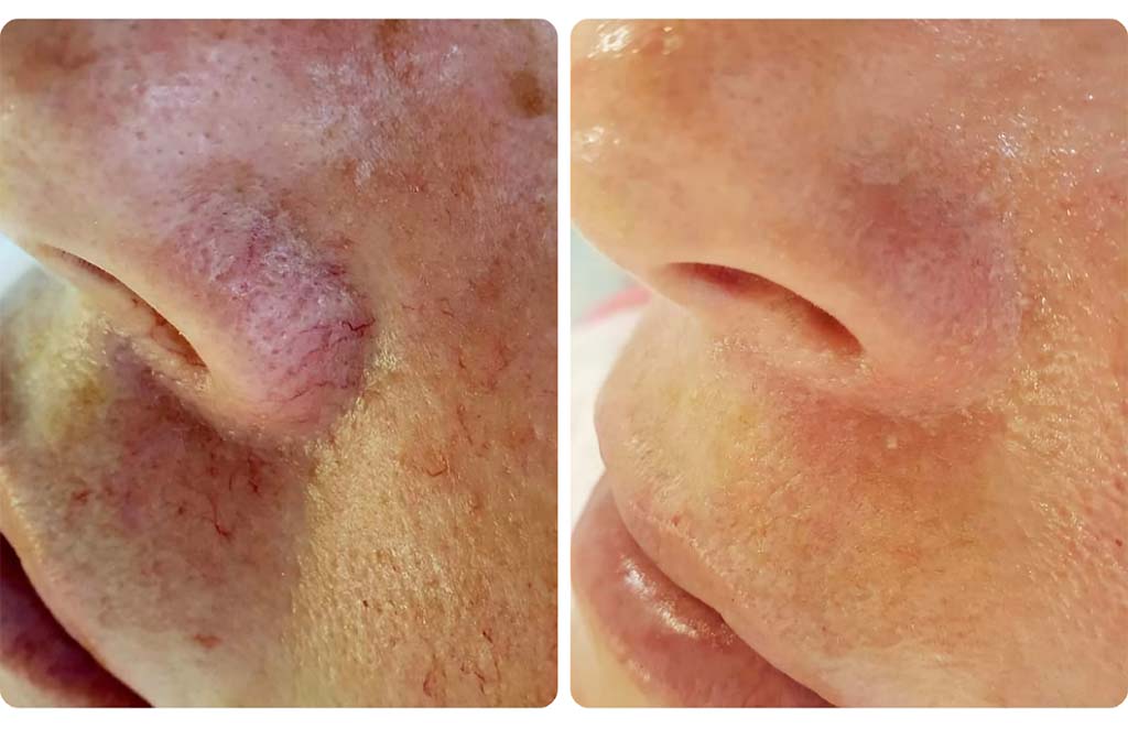 zabieg kosmetologiczny